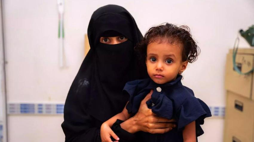 اليونيسف تطلق مبادرة تغذوية لتسريع الحد من نقص التغذية في اليمن